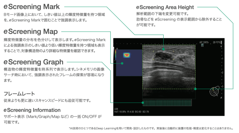eScreening(超音波検査機)