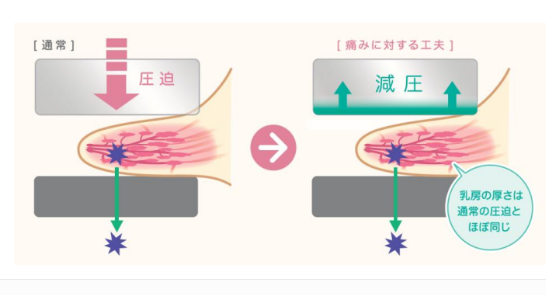 マンモグラフィ検査